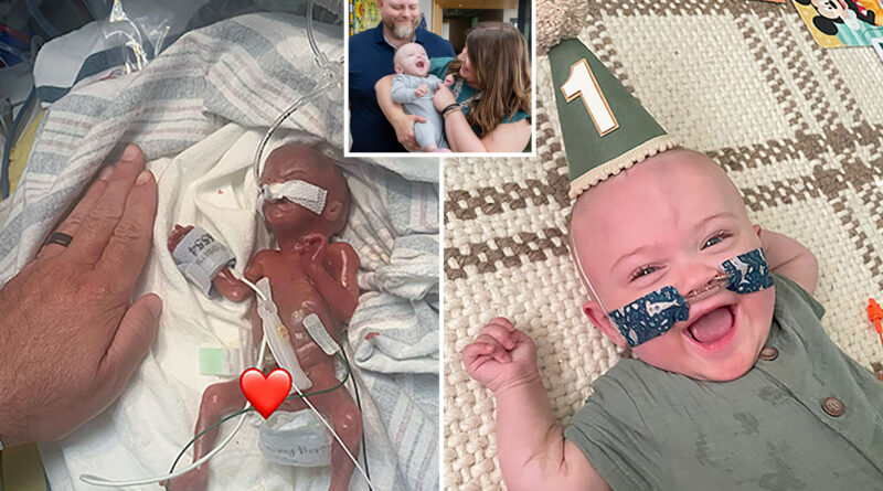 World’s most premature baby defies all medical odds to reach 1st birthday