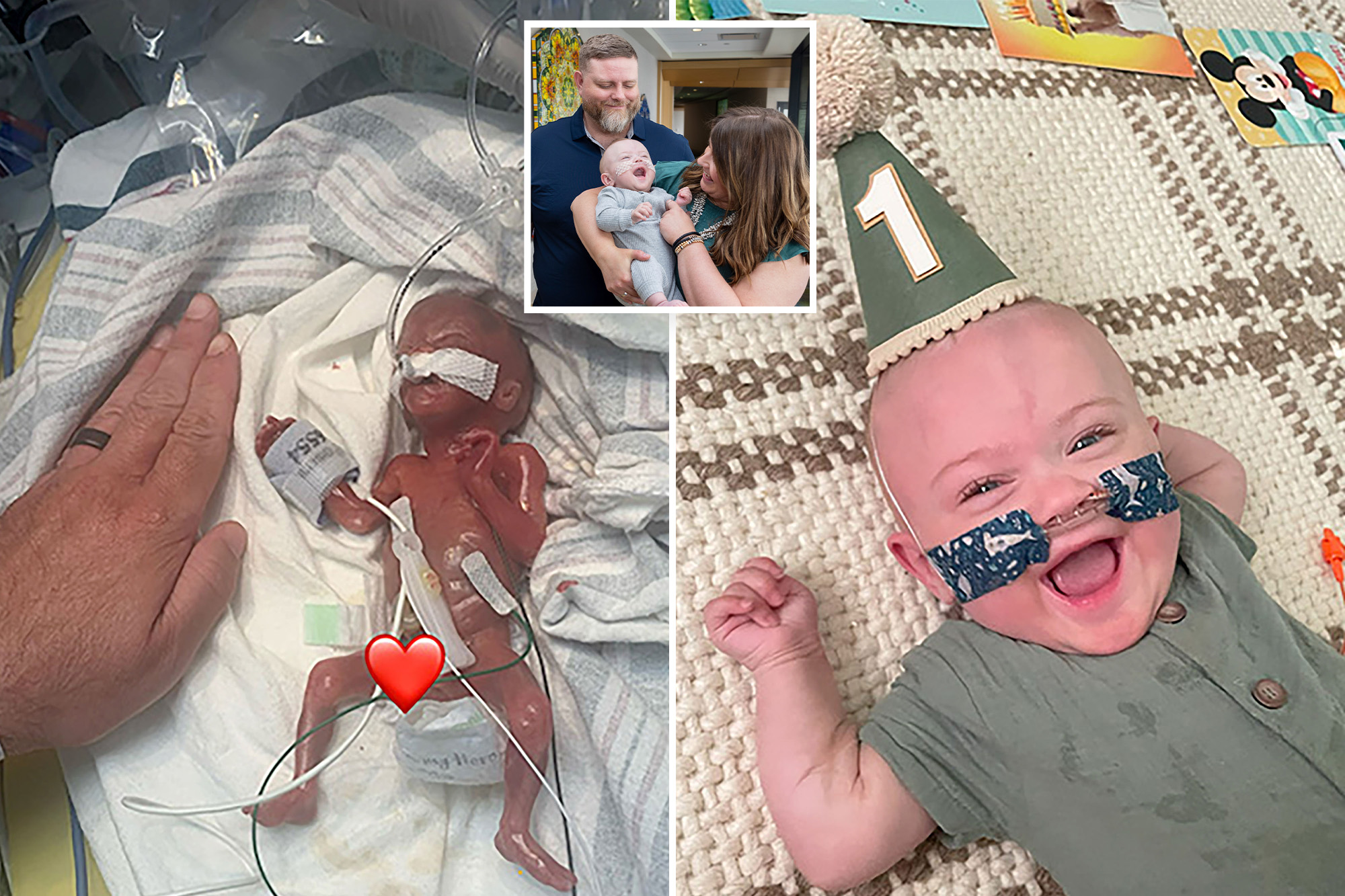 World’s most premature baby defies all medical odds to reach 1st birthday