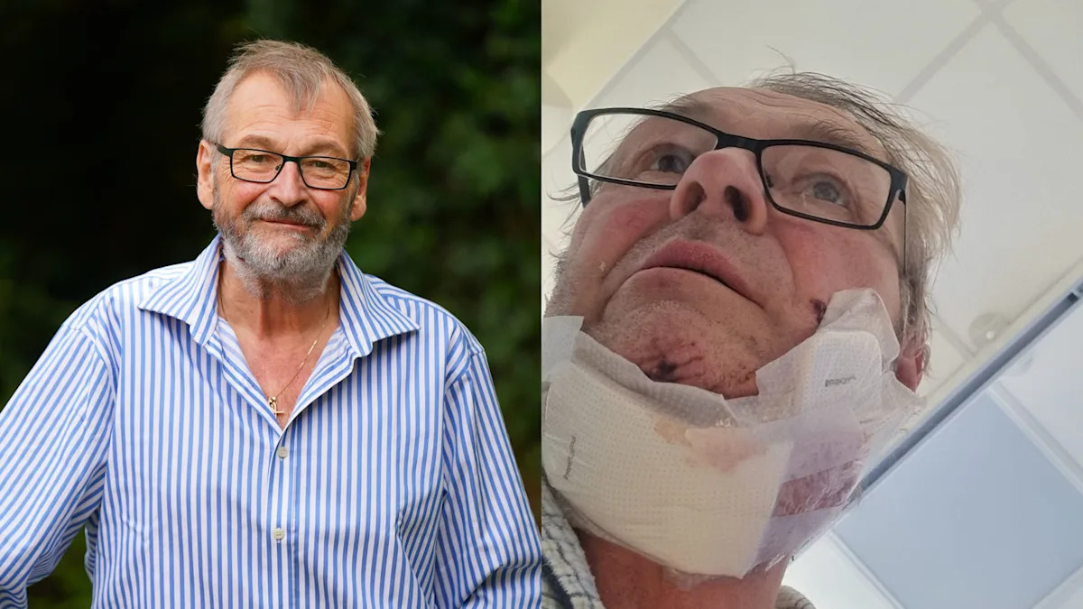 I accidentally slashed my neck with a chainsaw but cops thought my wife did it