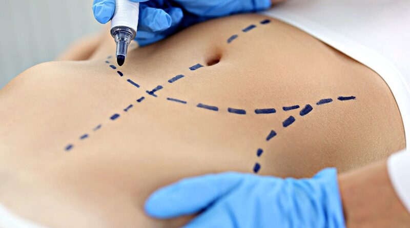 Top cosmetic procedures revealed in new report: What’s trending and why