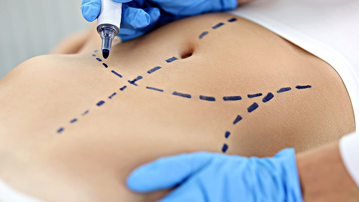 Top cosmetic procedures revealed in new report: What’s trending and why