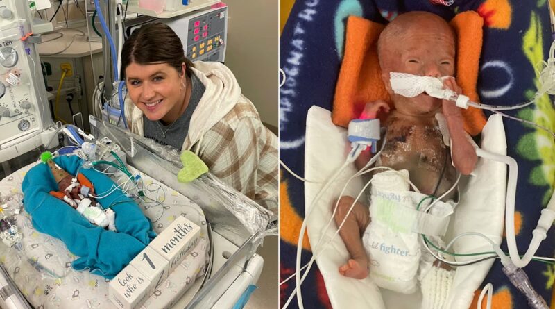 World’s most premature baby defies all medical odds to reach 1st birthday