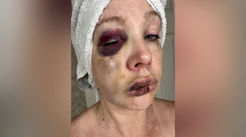 Three major broadcast networks didn’t report on heinous Cincinnati brawl, review finds